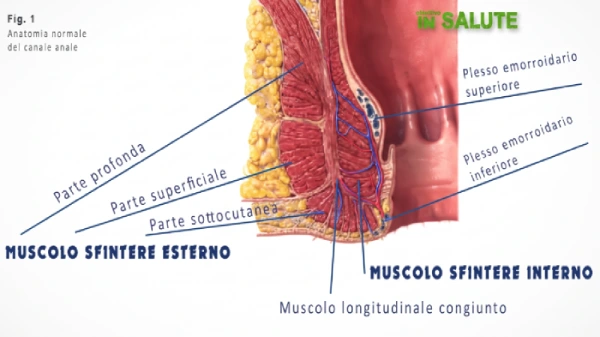 Sezione del muscolo sfintere interno ed esterno di un canale anale normale con indicazione di tutte le sue componenti