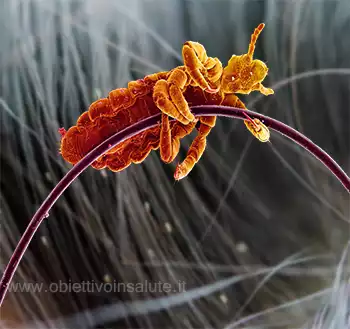 Ingrandimento di un pidocchio aggrappato a un capello