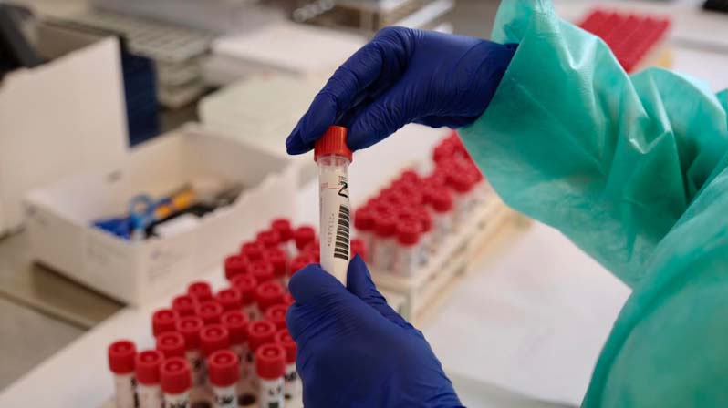 Medico esamina delle provette di sangue