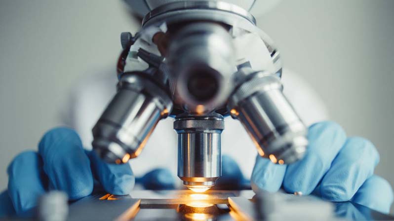 Medico esamina un vetrino con il virus covid-19 al microscopio