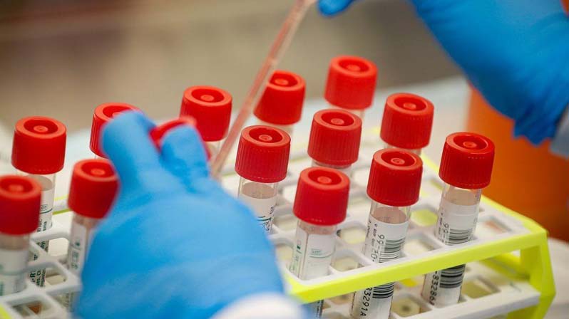 Infermiere testa alcune provette in laboratorio