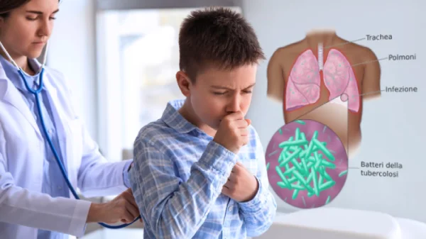 Una dottoressa visita con lo stetoscopio un bambino. Sullo sfondo c'è un'immagine dei polmoni invasi dal batterio della tubercolosi con evidenza dell'apparato respiratorio